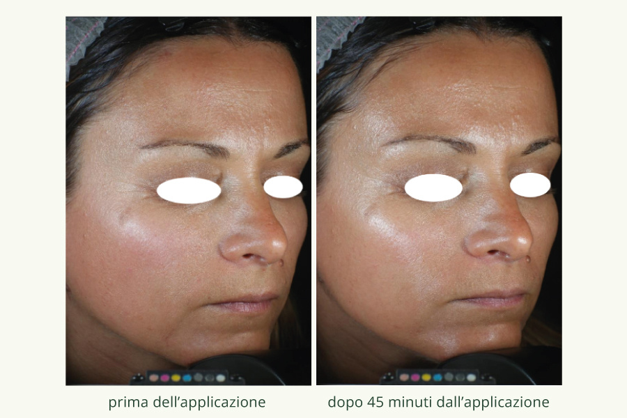 Collagene-vegetale-1