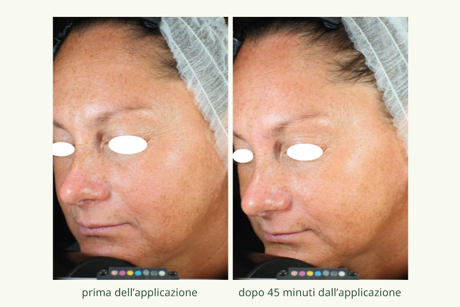 Collagene-vegetale-2
