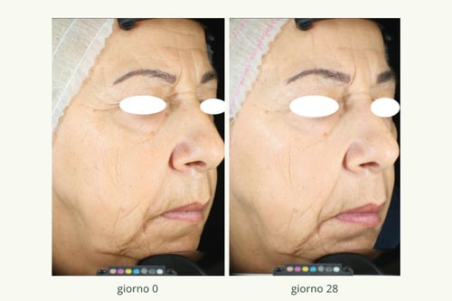 Fitoretinolo-2