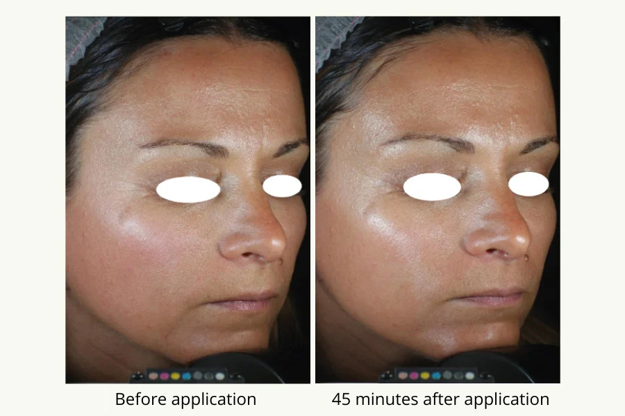 collagene-vegetale-1-eng